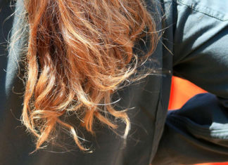 Leczenie trychologiczne - na czym polega?